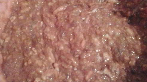 печеночные оладьи